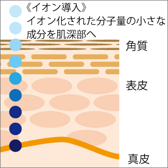 イオン導入