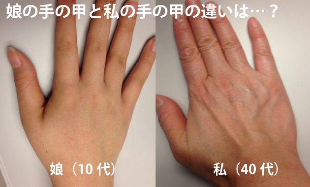 体を張った臨床例 土橋、痩せた真皮を復活させる編