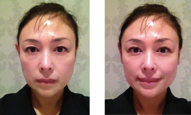 職業病?!人の『たるみ』が気になる私…
