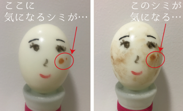 美容外科に行く前に伝えたい事。~リセラサロンでできる事。