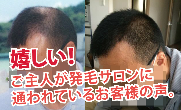 嬉しい!ご主人が発毛サロンに通われているお客様の声