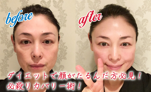 ダイエットで顔がたるんだ方必見!必殺リカバリー術!